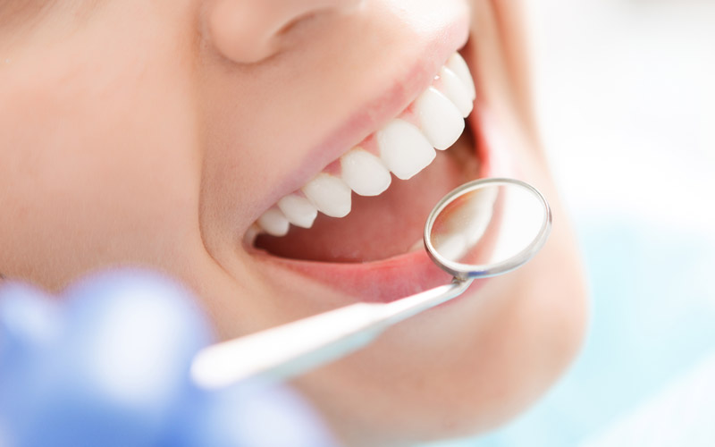 Kitsilano Dentist - Kitsilano Dental Services for families - White teeth and mirror